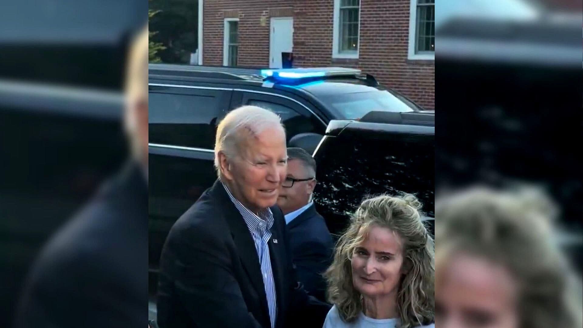 Joe Biden Reaparece con Cicatriz en la Cabeza tras Extirparle Células Cancerosas
