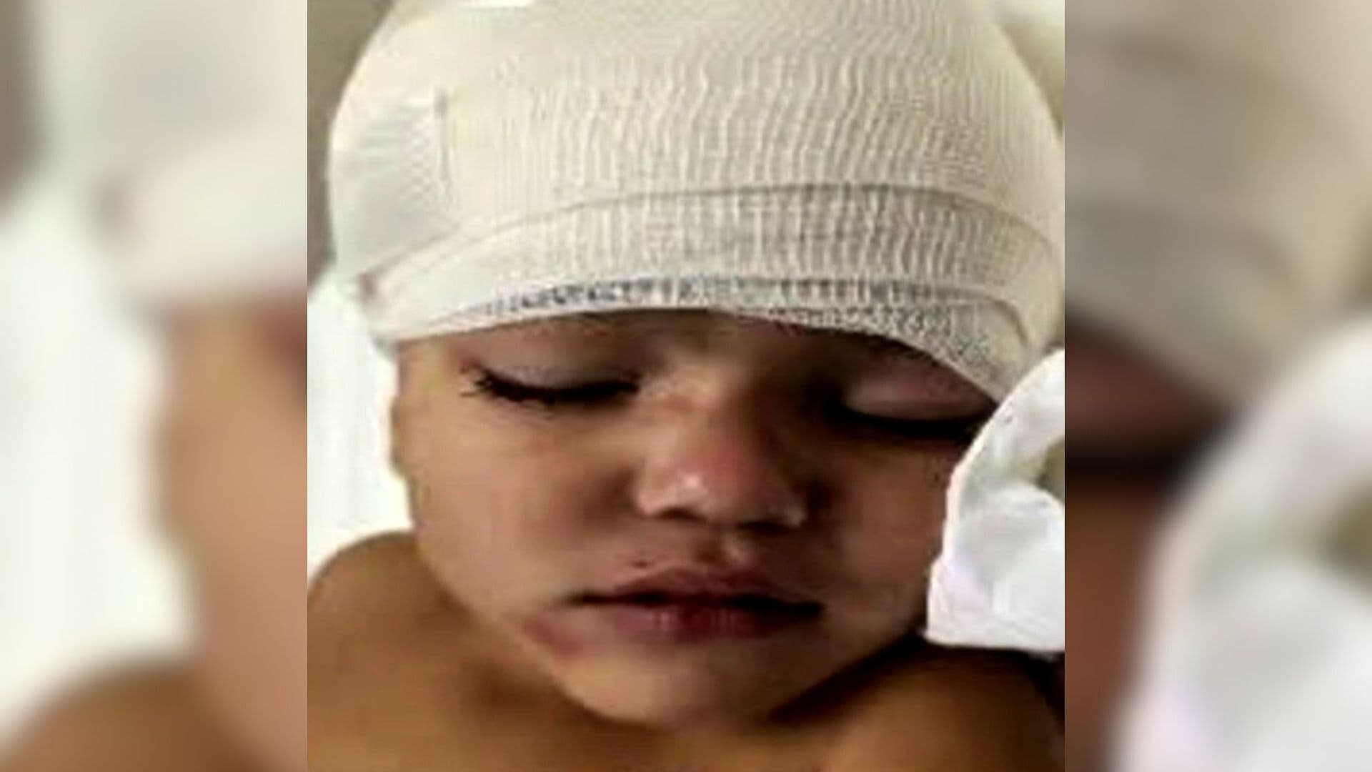 Identifican a Niña de 3 Años Herida en Accidente de Chalco; Familia Pide Apoyo Desde Venezuela